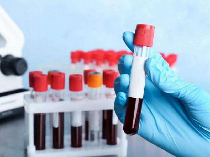Новости дня: Названа самая неуязвимая к онкологии группа крови