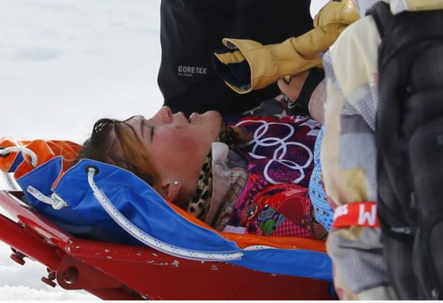 Мария Комиссарова. В 2014 году на одной из предолимпийских тренировок в Сочи на трассе ски-кросса она неудачно приземлилась, травмировав позвоночник.