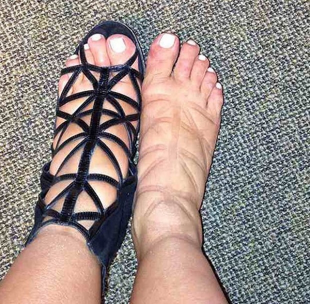 А это фото ног Ким большинство пользователей признали самым отвратительным, что им приходилось видеть.