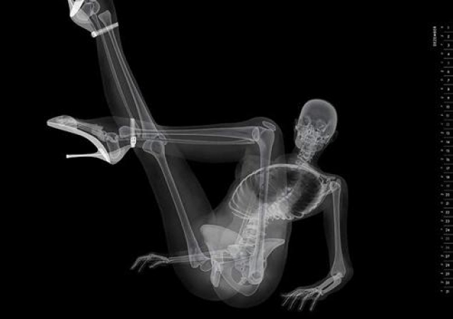 Самые откровенные позы в рентгене не выглядят таковыми.