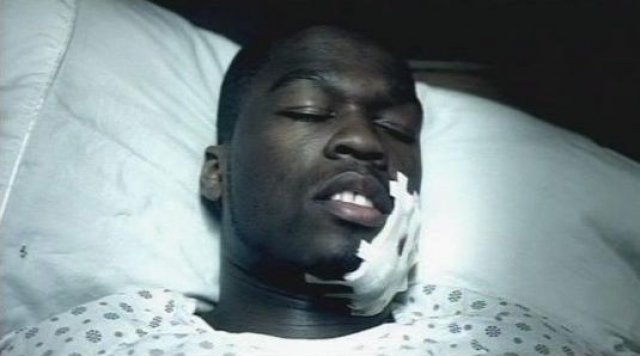 У 50 Cent были раны руки, бедра, обеих ног, груди и щеки.