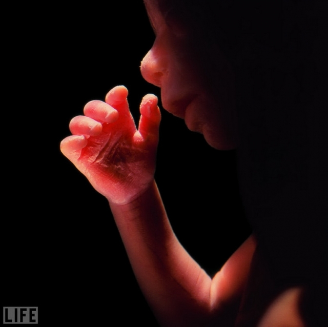 Дитя родилось (A Child Is Born, Lennart Nilsson, 1965). Первое в истории фото ребенка в утробе матери.