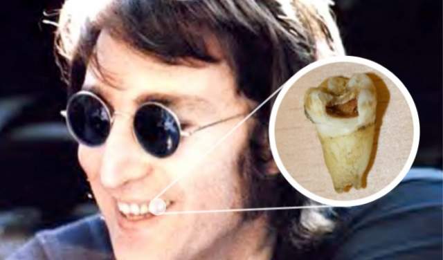 Лот на аукцион предоставил коллекционер Алан Макги, который получил его от родственников домработницы Леннона. Певец подарил женщине зуб, чтобы та передала его своей дочери, фанатевшей от группы The Beatles.