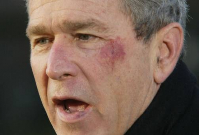 Джордж Буш находился на диване перед телевизором с пакетиком солёных кренделей и смотрел по телевизору матч Национальной лиги по американскому футболу, когда внезапно поперхнулся, потерял сознание и упал с дивана на пол, сильно оцарапав левую щеку.