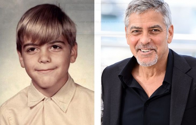 Джордж Клуни. В школе актера неожиданно поразил паралич, из-за которого у него не открывался левый глаз, из-за чего его дразнили Франкенштейном. Болезнь отступила через год, а воспоминания остались: "Это было худшее время в моей жизни. Меня высмеивали и дразнили, но это испытание сделало меня сильнее," - вспоминал Клуни.