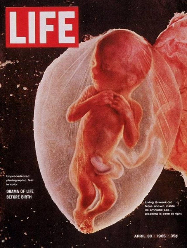 LIFE, апрель 1965. 18-недельный плод снят шведским фотографом Нильссоном с помощью эндоскопа. Это часть его книги "Рождение". Книга разошлась 8-миллионным тиражом за 4 дня.