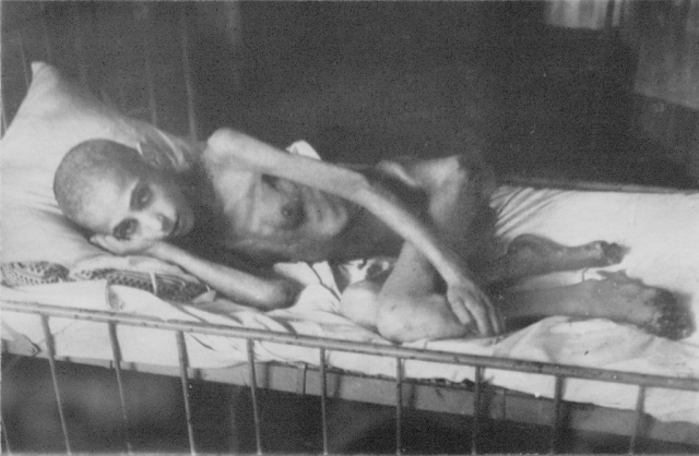 Больная дистрофией женщина, лежащая на кровати в блокадном Ленинграде.