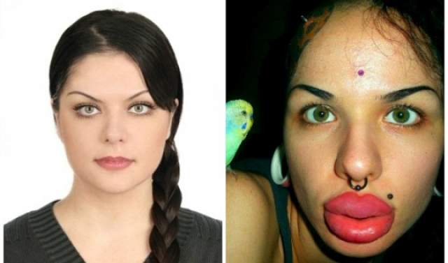 Кристина Рэй. В 22 года петербурженка попала в Книгу рекордов Гиннеса как обладательница самых больших губ в мире: с 17 лет Кристина сделала более 100 инъекций силикона.
