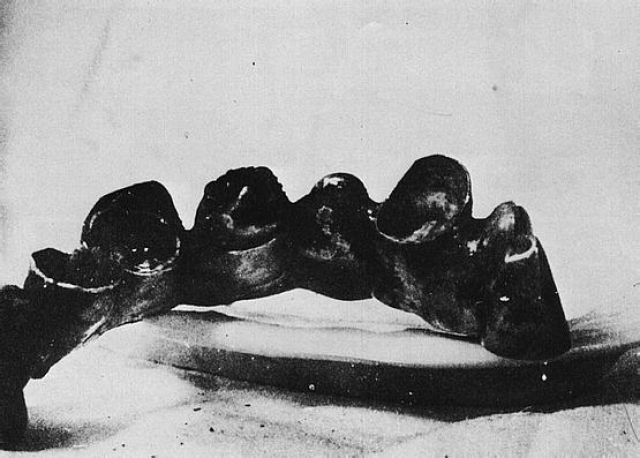 11 мая 1945 г. стоматолог Гайзерман подробно описала анатомические данные ротовой полости Гитлера, которые совпали с результатами исследования, проведенного 8 мая. 