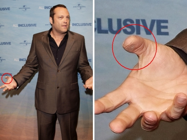У актера Винса Вона отсутствует кончик большого пальца правой руки.