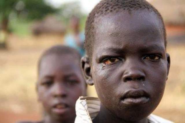 Кивательный синдром  Его открыли в Восточной Африке в 2010 году. В основном им страдают дети: пациенты постоянно кивают головой, что зачастую приводит к недоеданию и задержке роста. 