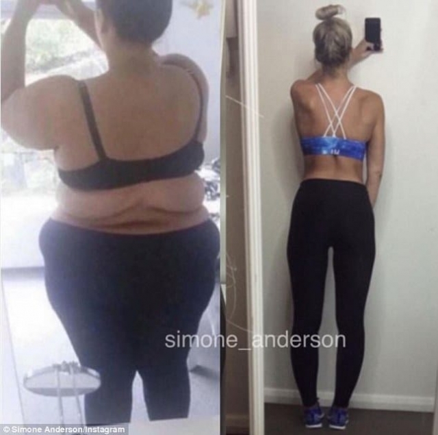 25-летняя Симон Андерсон весила 169 килограмм...