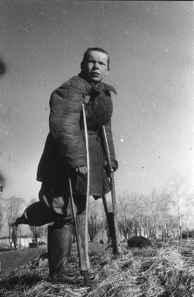 Подросток-калека в блокадном Ленинграде.