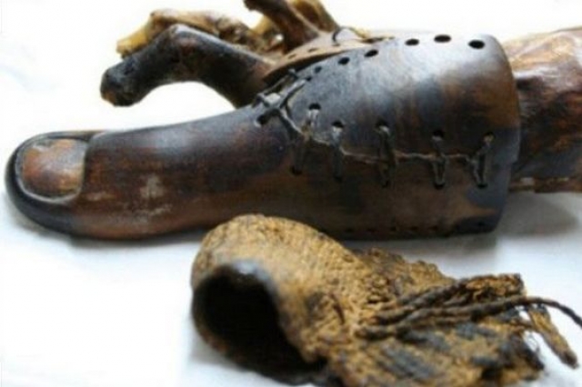 Протез. Первый протез был найден также в Египте. Палец из дерева и кожи был надет на женской мумии и датируется 950 годом до н.э.